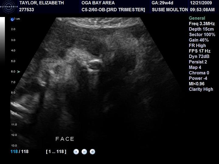 Downsized Image [AMT30weeks-1.jpg - 53kB]