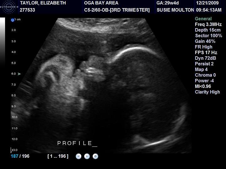 Audrey's Profile @ 30 Weeks