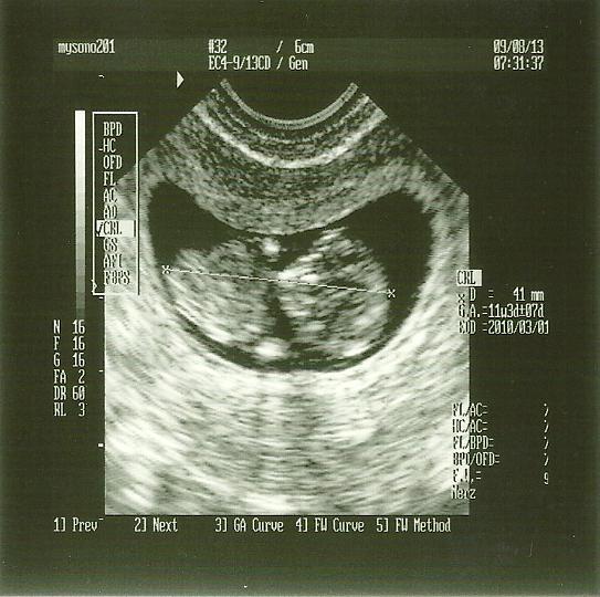 Downsized Image [BabyTaylor11weeks-1.jpg - 302kB]