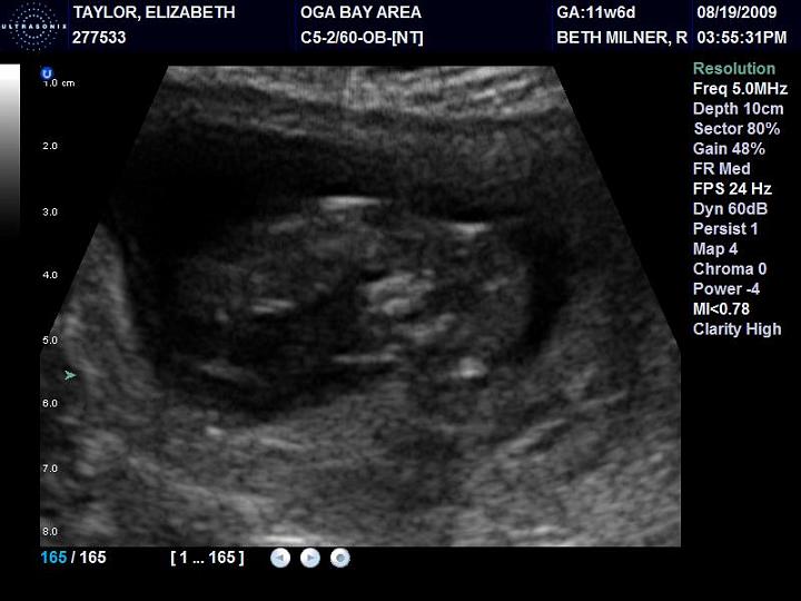 Downsized Image [BabyTaylor2_12weeks-1.jpg - 55kB]
