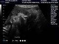 AMT30weeks-1.jpg