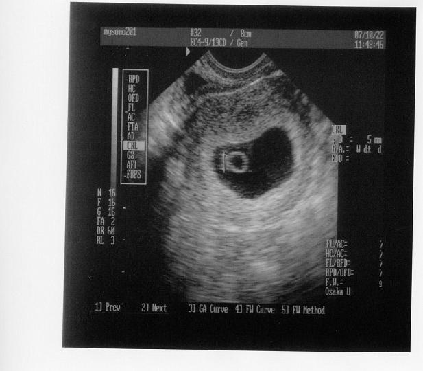 Baby Taylor (6 weeks)