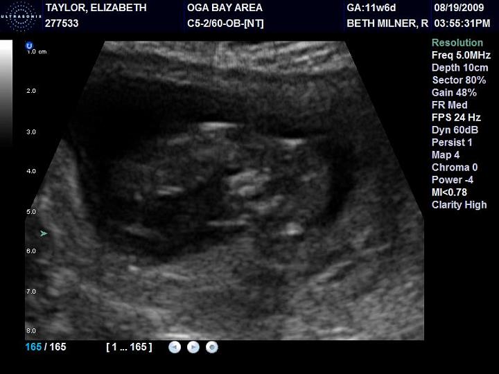 Baby Taylor #2 @ 12 Weeks