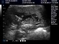 Baby Taylor (13 weeks)