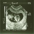 BabyTaylor11weeks-2.jpg