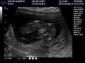 BabyTaylor2_12weeks-1.jpg